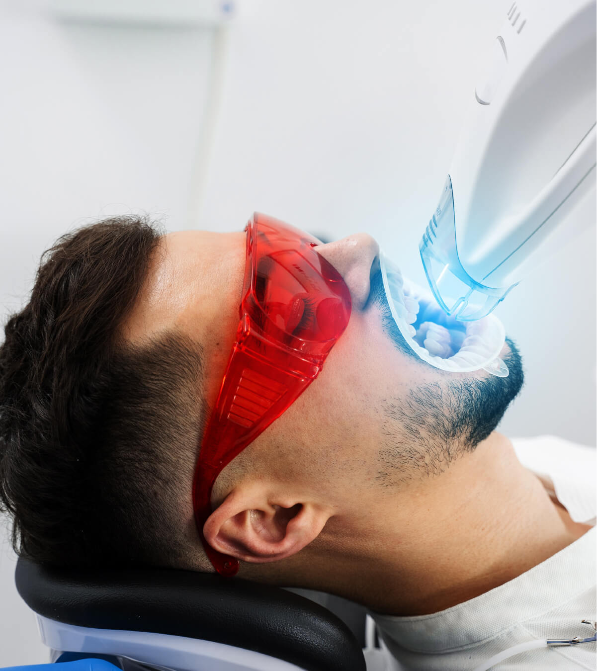 What Are Dental Crowns?